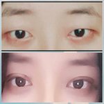 [드루와] 쌍수<b>전후</b>^**^^^^