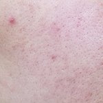 얼굴 하얘진 후기!!! (혐짤주의)