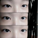 쌍수해야겠지?