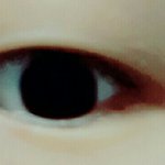 오늘 <b>쌍수</b>하는데 <b>라인</b>