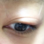 [인피니트] ㅅㄷ) 눈다래끼 나 본 토기들ㅜㅜ(사진지웠는데 왜 계속...