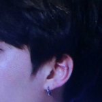 [방탄소년단] 윤기 귀 <b>상처</b>봐