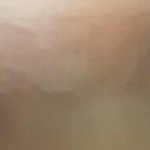 애들아 개급함 쌍수 <b>찜질</b>잇잖아 사진주의