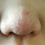 [댓글부탁해] 코 <b>각질</b> 제거법좀ㅜㅜㅜㅜ