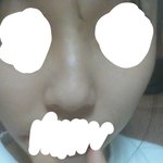 나처럼 코 심하게 휜애들있어?