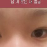 [댓글부탁해] 나보다 <b>짝눈</b> 심한사람 있어?