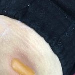 [꼭봐주세요] 전기장판으로인한 3<b>도화상</b> 나몰라라 어떡하죠