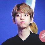 [EXO] 변백현 <b>다래끼</b> 이후로 정착한 쌍커풀차이