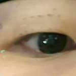 [댓글부탁해] 쌍수후기!!!!궁금한<b>점들</b>어왕