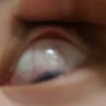 [댓글부탁해] 극혐) 진심 <b>써클</b> 렌즈 오래 끼지 마
