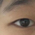 [조언부탁해] 쌍수가 너무 하고싶은데ㅜㅅㅜ