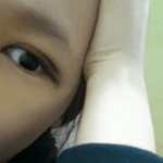 빛삭)쌍수<b>몇일</b>된거같아??