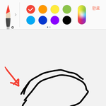 <b>쌍수</b>했는데 <b>라인</b>이 2개야