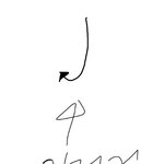 [EXO] <b>함몰</b>유 수술후기알려줌