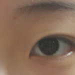 [댓글부탁해] 쌍수할건데 <b>라인</b>뭘루할까?