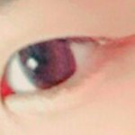 [조언부탁해] 무쌍<b>인대</b> 쌍수 조언좀해주세요ㅜㅜㅠㅠ