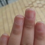 [드루와] <b>손톱</b>못난애들 무조건들어와!!