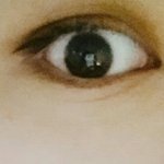 나 <b>짝눈</b>인데 쌍수할까