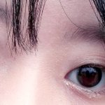 [드루와] 나 쌍수할까? (사진ㅇ)