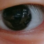 [댓글부탁해] 나 무<b>쌍</b>인데 쌍수하면 괜찮을것같아?