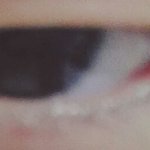 나<b>쌍수</b>앞트임평가좀