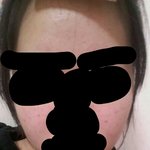 [조언부탁해] 아 여드름 <b>흉터</b> ㄹㅇㅠㅠㅍ