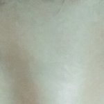 [댓글부탁해] <b>쌍수</b> 2주차 붓기랑 라인 좀 봐 줘ㅠㅠ!
