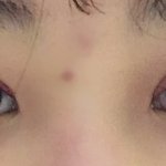 <b>쌍수</b> 잘 된거같아?