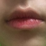 [댓글부탁해] 교정에 대해서 알면 들어와줘 제발 ㅠㅠㅠ