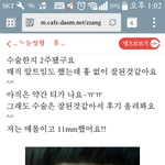 나도 진짜 조카 소름돋는거 봄