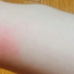 [EXO] ㅅㅂ휘적거리다가 부딪혔는데 조카 아파