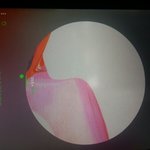 [EXO] 12시좀넘어서 <b>몬스터</b> 1억뷰넘을거같다