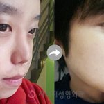 [ㅋㅋㅋㅋㅋ] 성형<b>전후</b> 중에 이게 제일 쩌는 것 같음