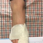 [개깊은빡침] 8살짜리 아이 혼자 엠브런스에 태워서 응급실에 보낸...