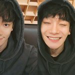 [EXO] ㅅ1발 애기