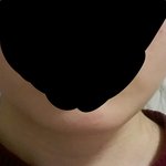 [댓글부탁해] 내턱 살이야 <b>뼈</b>야?