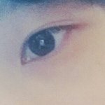 너네 같으면 쌍수할거야?
