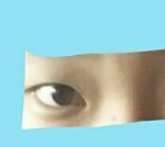 앞트임+쌍수+<b>눈매</b>교정 할까?