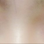 나 쌍수 <b>재수술</b>할까?ㅠㅜㅜ