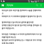 [드루와] <b>비절개</b> 뒤트임도 생각보다 안전하지 않아