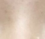 [조언부탁해] 나 눈매교정이랑 <b>지방제거</b> 할건뎅 경험자들 잇어??