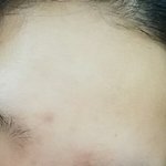 [드루와] 피부 뒤집어졌는데