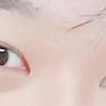 나 쌍수+앞트임 했는데 많이 <b>티나</b>?