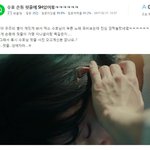 헐 수호 손등에 <b>핏줄</b>