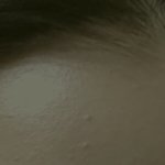 [댓글부탁해] (<b>약</b>혐) <b>무슨</b>여드름이야