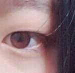 쌍수랑 앞트임 해? 말아?