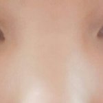 얘들아 나 코수술 해야 할까 ㅜㅜ?