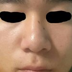 [다이어트] <b>판친구들</b> 콧볼..