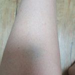 [이삐] 아니 솔직히..고척은