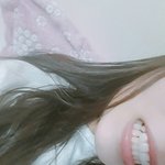 나 <b>치아</b> 어때???